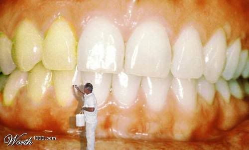 blanqueamiento dental (c) friendscail costo de blanqueamiento dental