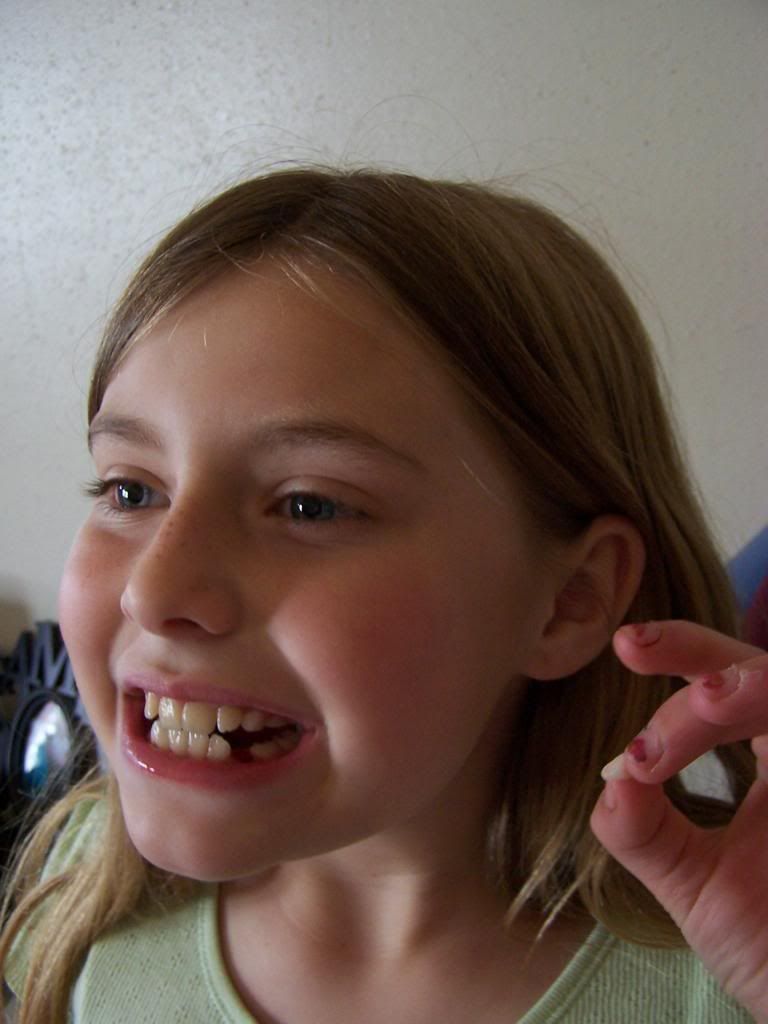 lost tooth photo Maysoaps002_zpsb918fa22.jpg